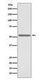 Cell Division Cycle 25C antibody, M01343, Boster Biological Technology, Western Blot image 