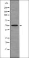 Transforming Growth Factor Beta 1 Induced Transcript 1 antibody, orb335732, Biorbyt, Western Blot image 