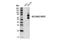 ROS Proto-Oncogene 1, Receptor Tyrosine Kinase antibody, 15027S, Cell Signaling Technology, Western Blot image 
