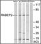Rabaptin, RAB GTPase Binding Effector Protein 2 antibody, orb178964, Biorbyt, Western Blot image 