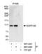 Nucleolar and coiled-body phosphoprotein 1 antibody, NBP1-22981, Novus Biologicals, Western Blot image 