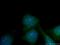 Centrosomal Protein 70 antibody, 16280-1-AP, Proteintech Group, Immunofluorescence image 
