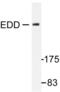 Ubiquitin Protein Ligase E3 Component N-Recognin 5 antibody, LS-C176336, Lifespan Biosciences, Western Blot image 