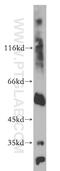 UDG antibody, 12394-1-AP, Proteintech Group, Western Blot image 