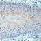 CD44 antibody, SM1111P, Origene, Immunohistochemistry frozen image 