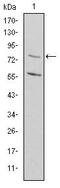 Methylenetetrahydrofolate reductase antibody, MA5-15844, Invitrogen Antibodies, Western Blot image 