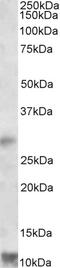 Acetyl-CoA Acetyltransferase 1 antibody, 43-137, ProSci, Western Blot image 