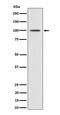 MDM2 Proto-Oncogene antibody, P00054-2, Boster Biological Technology, Western Blot image 