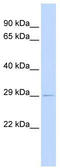 Proteasome assembly chaperone 1 antibody, TA338919, Origene, Western Blot image 