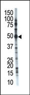 Ubiquitin carboxyl-terminal hydrolase 12 antibody, AP12026PU-N, Origene, Western Blot image 