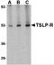 Cytokine receptor-like factor 2 antibody, 4207, ProSci Inc, Western Blot image 