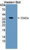 Nei Like DNA Glycosylase 1 antibody, LS-C373773, Lifespan Biosciences, Western Blot image 