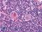 HAP3 antibody, LS-B718, Lifespan Biosciences, Immunohistochemistry paraffin image 