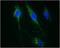 Carnitine Palmitoyltransferase 1A antibody, ab128568, Abcam, Immunocytochemistry image 
