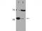 DNA Polymerase Beta antibody, TA319428, Origene, Western Blot image 