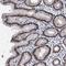 Zinc Finger Protein 529 antibody, NBP1-81396, Novus Biologicals, Immunohistochemistry paraffin image 