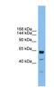 Uromodulin Like 1 antibody, NBP1-80535, Novus Biologicals, Western Blot image 