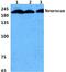 Neurocan antibody, PA5-36994, Invitrogen Antibodies, Western Blot image 