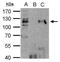 Histone Deacetylase 7 antibody, PA5-29937, Invitrogen Antibodies, Immunoprecipitation image 