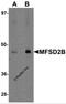 Major Facilitator Superfamily Domain Containing 2B antibody, 6027, ProSci, Western Blot image 