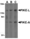 Arf-GAP with GTPase, ANK repeat and PH domain-containing protein 2 antibody, TA306168, Origene, Western Blot image 