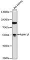 RNA Binding Motif Protein, Y-Linked, Family 1, Member J antibody, A19015, Boster Biological Technology, Western Blot image 