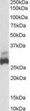 Sdh1 antibody, GTX89491, GeneTex, Western Blot image 