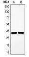 Vascular Endothelial Growth Factor D antibody, LS-C352199, Lifespan Biosciences, Western Blot image 