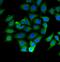 NFKB Inhibitor Beta antibody, FNab04199, FineTest, Immunofluorescence image 