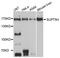 SPT5 Homolog, DSIF Elongation Factor Subunit antibody, A03426, Boster Biological Technology, Western Blot image 