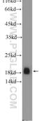 Vesicle-associated membrane protein 2 antibody, 10135-1-AP, Proteintech Group, Western Blot image 