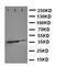Zinc Finger E-Box Binding Homeobox 2 antibody, orb97085, Biorbyt, Western Blot image 