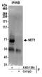Neuroepithelial Cell Transforming 1 antibody, A303-138A, Bethyl Labs, Immunoprecipitation image 