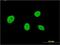 Nucleolar Protein 4 antibody, H00008715-M01, Novus Biologicals, Immunofluorescence image 