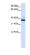 2'-5'-Oligoadenylate Synthetase 1 antibody, NBP1-58950, Novus Biologicals, Western Blot image 