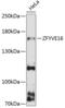Zinc Finger FYVE-Type Containing 16 antibody, 14-823, ProSci, Western Blot image 