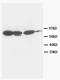 Junction Plakoglobin antibody, AM20592PU-N, Origene, Western Blot image 