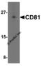 CD81 Molecule antibody, 5195, ProSci, Western Blot image 