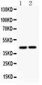 RUNX Family Transcription Factor 3 antibody, LS-C313230, Lifespan Biosciences, Western Blot image 