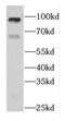DIS3 Like 3'-5' Exoribonuclease 2 antibody, FNab02396, FineTest, Western Blot image 