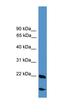 RNA Binding Motif Protein 18 antibody, orb324930, Biorbyt, Western Blot image 