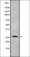 TBR2 antibody, orb337339, Biorbyt, Western Blot image 
