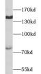 PC2 antibody, FNab01837, FineTest, Western Blot image 