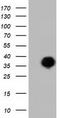 LRAT Domain Containing 2 antibody, TA501916S, Origene, Western Blot image 