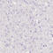 SIX Homeobox 1 antibody, AMAb90544, Atlas Antibodies, Immunohistochemistry paraffin image 