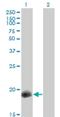 Protein Phosphatase 1 Regulatory Inhibitor Subunit 14A antibody, H00094274-M01, Novus Biologicals, Western Blot image 