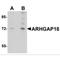 Rho GTPase Activating Protein 18 antibody, MBS150719, MyBioSource, Western Blot image 