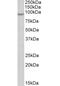 NADPH oxidase 5 antibody, OAEB01075, Aviva Systems Biology, Western Blot image 