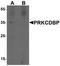 Protein kinase C delta-binding protein antibody, A32244, Boster Biological Technology, Western Blot image 