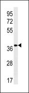 2-oxoglutarate receptor 1 antibody, LS-C203798, Lifespan Biosciences, Western Blot image 